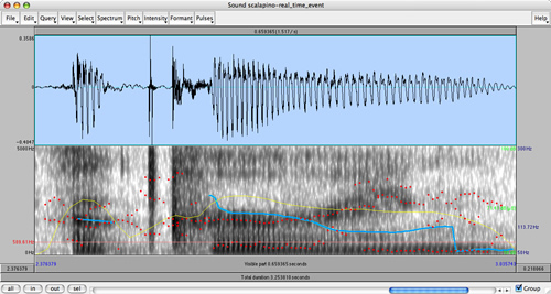 Voice visualization