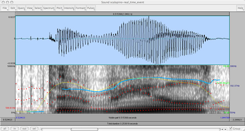 Voice visualization