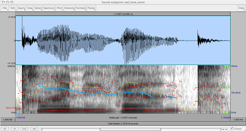 Voice visualization